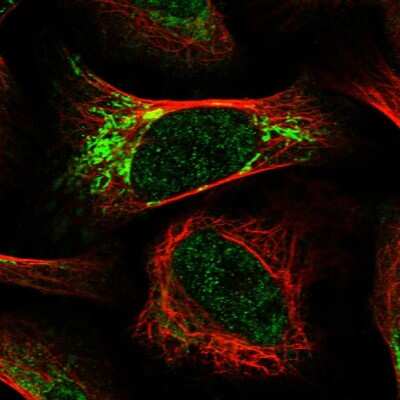 Immunocytochemistry/ Immunofluorescence: RTKN Antibody [NBP1-88956]