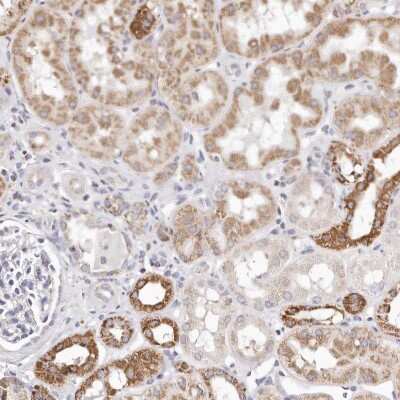 Immunohistochemistry-Paraffin: RTKN Antibody [NBP1-88956]