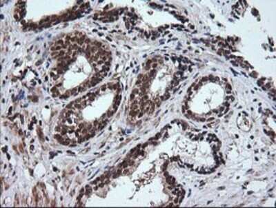 Immunohistochemistry: RTKN Antibody (OTI2E9) - Azide and BSA Free [NBP2-73950]