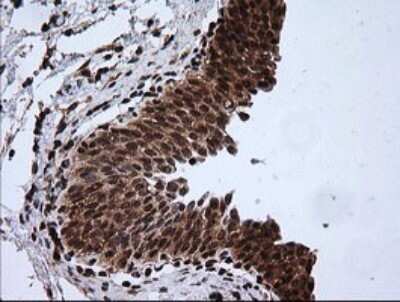 Immunohistochemistry: RTKN Antibody (OTI2E9) - Azide and BSA Free [NBP2-73950]