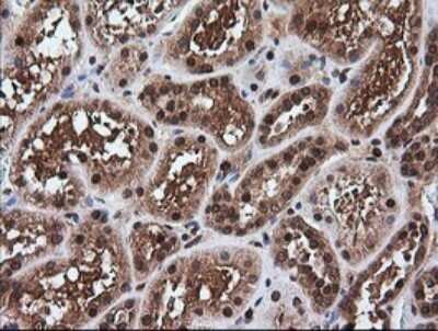 Immunohistochemistry: RTKN Antibody (OTI2E9) - Azide and BSA Free [NBP2-73950]
