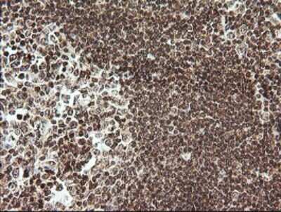 Immunohistochemistry: RTKN Antibody (OTI2E9) - Azide and BSA Free [NBP2-73950]