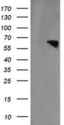 Western Blot: RTKN Antibody (OTI2E9)Azide and BSA Free [NBP2-73950]