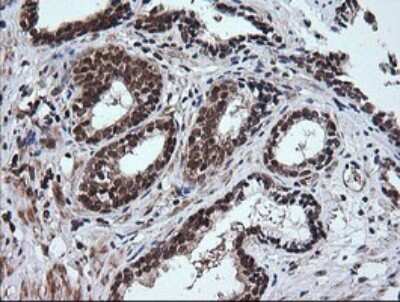 Immunohistochemistry-Paraffin: RTKN Antibody (OTI2E9) [NBP2-45966]