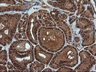 Immunohistochemistry-Paraffin: RTKN Antibody (OTI2E9) [NBP2-45966]