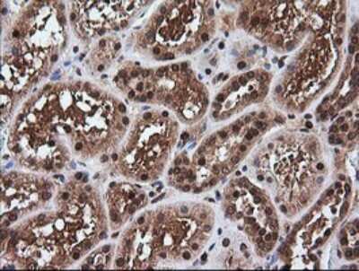 Immunohistochemistry-Paraffin: RTKN Antibody (OTI2E9) [NBP2-45966]
