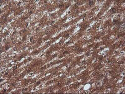 Immunohistochemistry-Paraffin: RTKN Antibody (OTI2E9) [NBP2-45966]