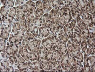 Immunohistochemistry-Paraffin: RTKN Antibody (OTI2E9) [NBP2-45966]