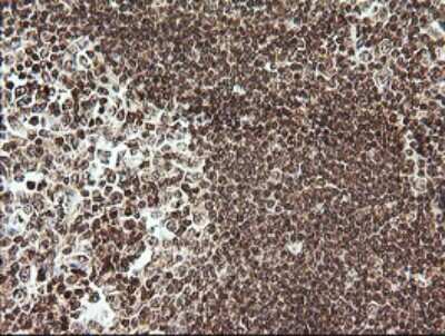 Immunohistochemistry-Paraffin: RTKN Antibody (OTI2E9) [NBP2-45966]