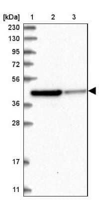 Western Blot: RTKN Antibody [NBP1-88956]