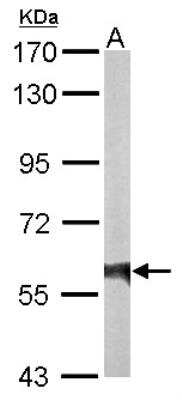 Western Blot: RTKN Antibody [NBP2-20239]