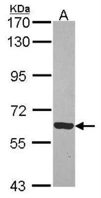 Western Blot: RTKN Antibody [NBP2-20239]