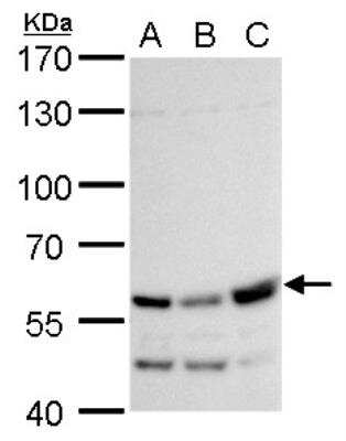 Western Blot: RTKN Antibody [NBP2-20239]