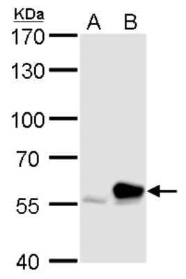 Western Blot: RTKN Antibody [NBP2-20239]