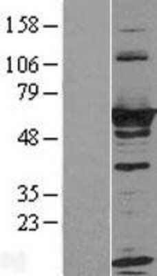 Western Blot: RTKN Overexpression Lysate [NBL1-15609]