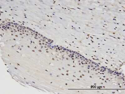 Immunohistochemistry-Paraffin: RTKN2 Antibody (2C2) [H00219790-M03]