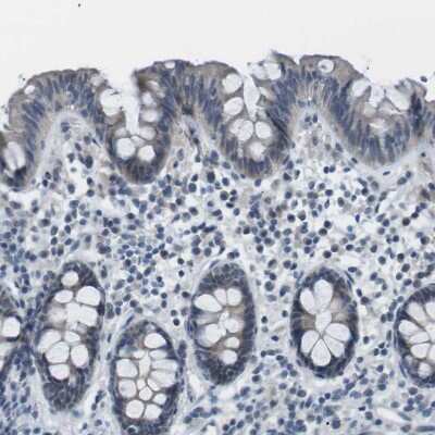 Immunohistochemistry-Paraffin: RTN3 Antibody [NBP1-88870]