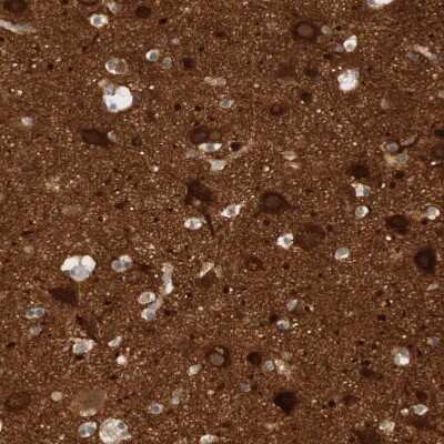 Immunohistochemistry-Paraffin: RTN3 Antibody [NBP1-88871]