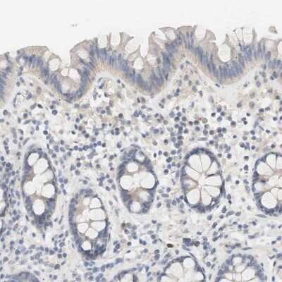 Immunohistochemistry-Paraffin: RTN3 Antibody [NBP1-88871]