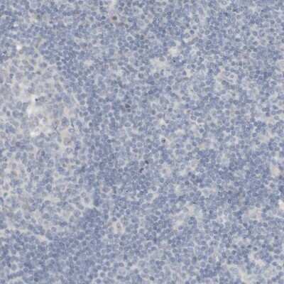 Immunohistochemistry-Paraffin: RTN3 Antibody [NBP1-88871]