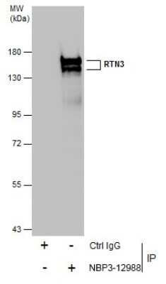 Immunoprecipitation: RTN3 Antibody [NBP3-12988]