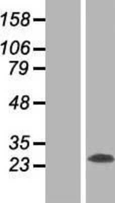 Western Blot: RTN3 Overexpression Lysate [NBP2-07679]