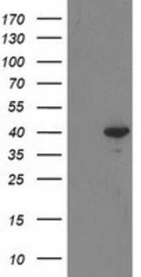 Western Blot: RTN4IP1 Antibody (OTI3B2) [NBP2-00478]