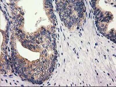 Immunohistochemistry: RTN4IP1 Antibody (OTI3B2) - Azide and BSA Free [NBP2-73952]
