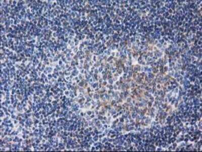 Immunohistochemistry: RTN4IP1 Antibody (OTI3B2) - Azide and BSA Free [NBP2-73952]