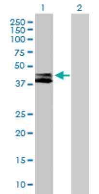 Western Blot: RTN4IP1 Antibody [H00084816-B01P]