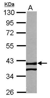 Western Blot: RTN4IP1 Antibody [NBP2-20240]