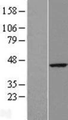 Western Blot: RTN4IP1 Overexpression Lysate [NBL1-15613]