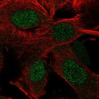 Immunocytochemistry/ Immunofluorescence: RTP4 Antibody [NBP2-39040]