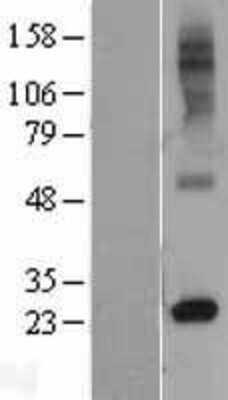 Western Blot: RTP4 Overexpression Lysate [NBL1-15618]