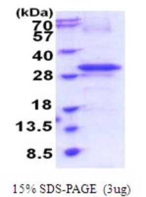 SDS-PAGE: Recombinant Human RTP4 His Protein [NBP2-51915]