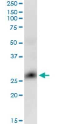 Western Blot: RTVP-1/GLIPR1 Antibody (8D9) [H00011010-M04]