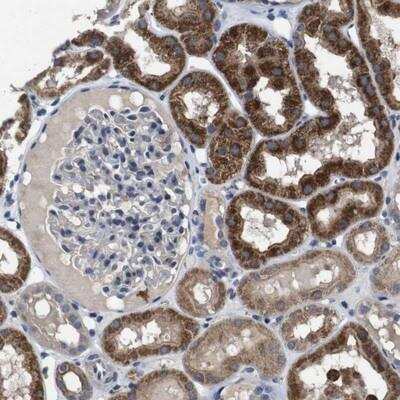 Immunohistochemistry-Paraffin: RTVP-1/GLIPR1 Antibody [NBP1-81825]