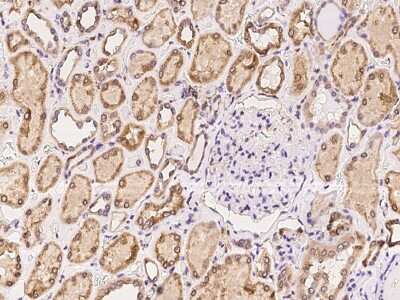 Immunohistochemistry-Paraffin: RTVP-1/GLIPR1 Antibody [NBP2-97340]