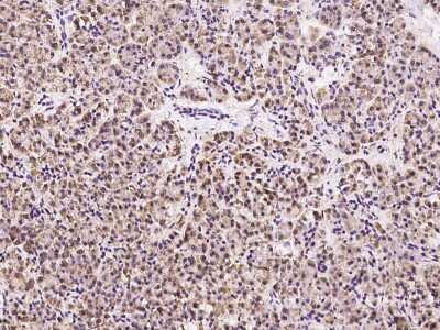 Immunohistochemistry-Paraffin: RTVP-1/GLIPR1 Antibody [NBP2-97340]