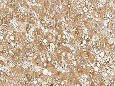 Immunohistochemistry-Paraffin: RTVP-1/GLIPR1 Antibody [NBP2-99206]