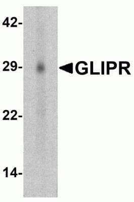 Western Blot: RTVP-1/GLIPR1 AntibodyBSA Free [NBP2-82032]