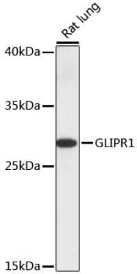 Western Blot: RTVP-1/GLIPR1 AntibodyAzide and BSA Free [NBP2-94550]