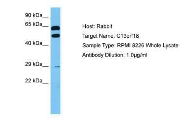 Western Blot: RUBCNL Antibody [NBP2-88201]