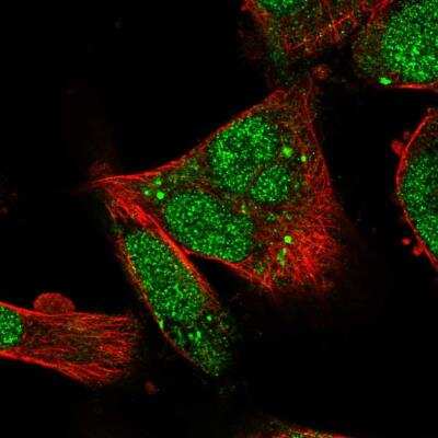 Immunocytochemistry/ Immunofluorescence: RUFY1 Antibody [NBP2-76553]