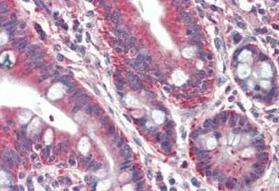 Immunohistochemistry-Paraffin: RUFY1 Antibody [NBP1-68865]
