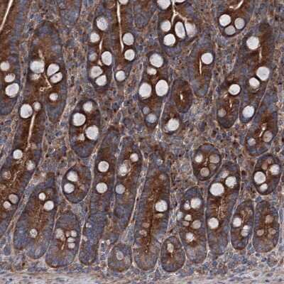 Immunohistochemistry-Paraffin: RUFY1 Antibody [NBP1-83606]