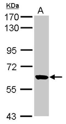 Western Blot: RUFY1 Antibody [NBP2-20241]