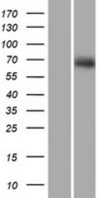 Western Blot: RUNDC1 Overexpression Lysate [NBP2-05149]