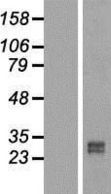 Western Blot: RUNDC2B Overexpression Lysate [NBL1-15622]