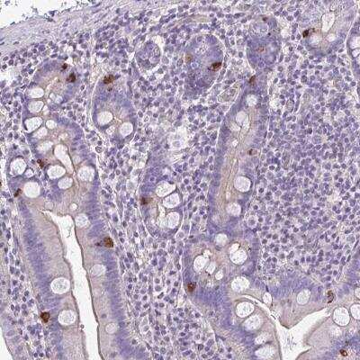 Immunohistochemistry-Paraffin: RUNDC3B Antibody [NBP2-31661]